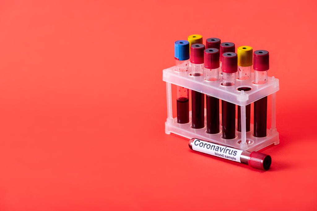 reageerbuis met bloedmonster en coronavirus letters op rood  - Foto, afbeelding