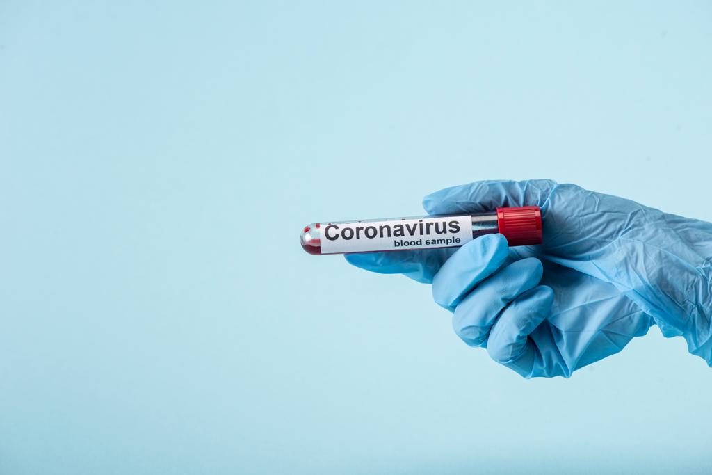 vista cortada do cientista em luva de látex segurando tubo de ensaio com amostra de sangue isolado em azul
  - Foto, Imagem