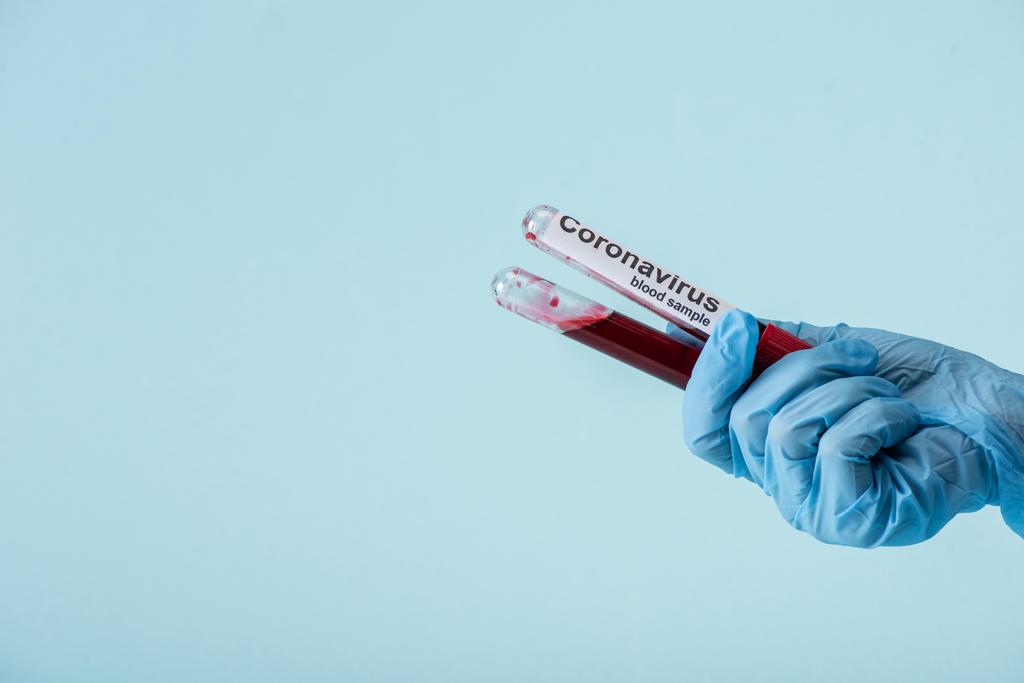 ラテックス手袋の科学者のクロップドビュー青に単離された血液サンプルと試験管を保持  - 写真・画像