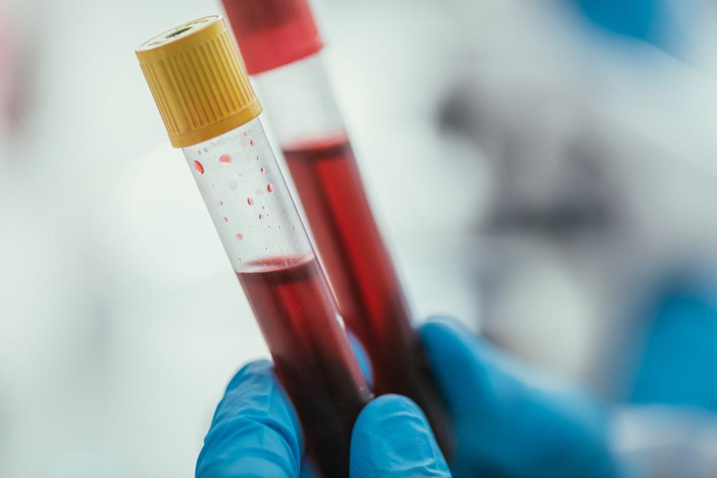 частичный взгляд биохимика, держащего пробирки с образцами крови
 - Фото, изображение