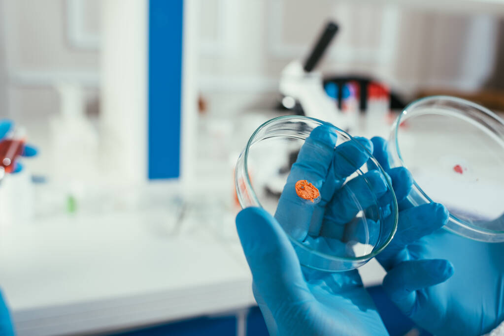 vista recortada del bioquímico en guantes de goma que sostienen placas de Petri con biomaterial
 - Foto, Imagen