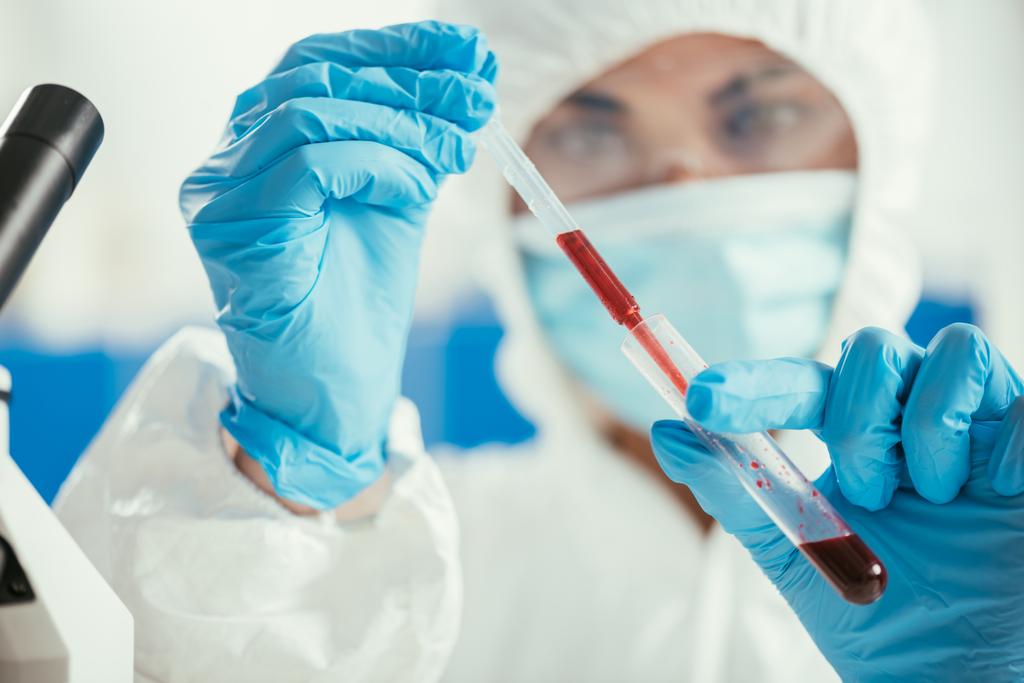 foco seletivo do bioquímico que tira a amostra de sangue do tubo de ensaio com pipeta
 - Foto, Imagem