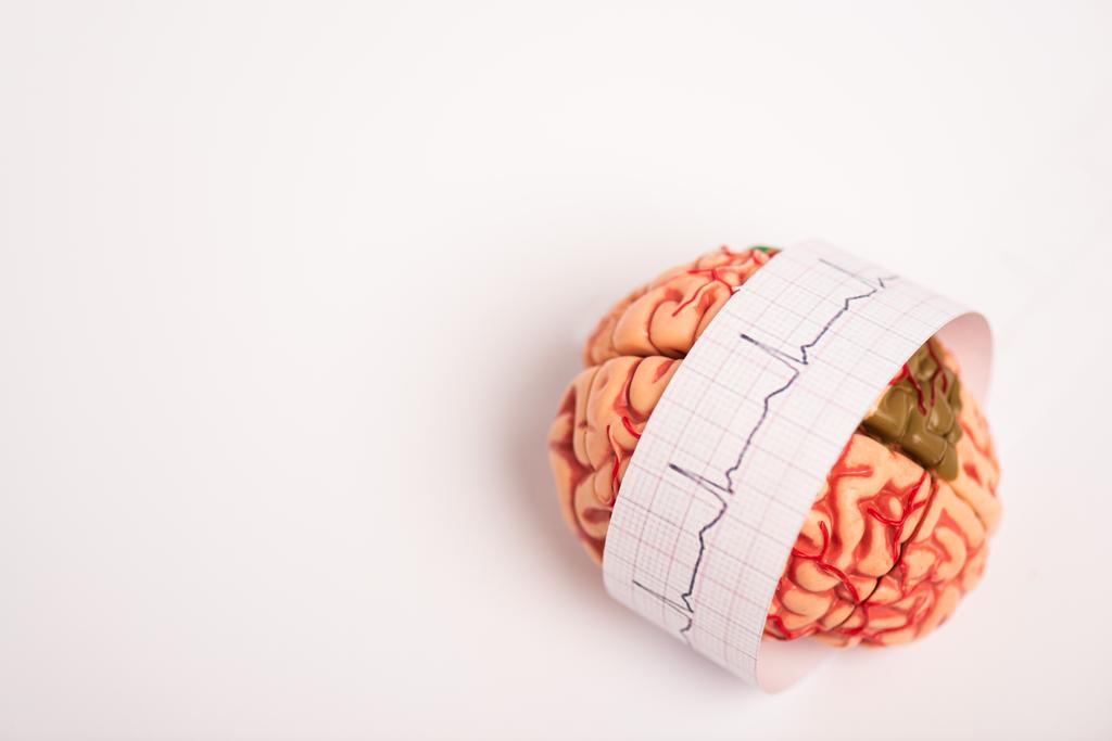 Mozkový model s elektrokardiogramem na papíře na bílém pozadí - Fotografie, Obrázek
