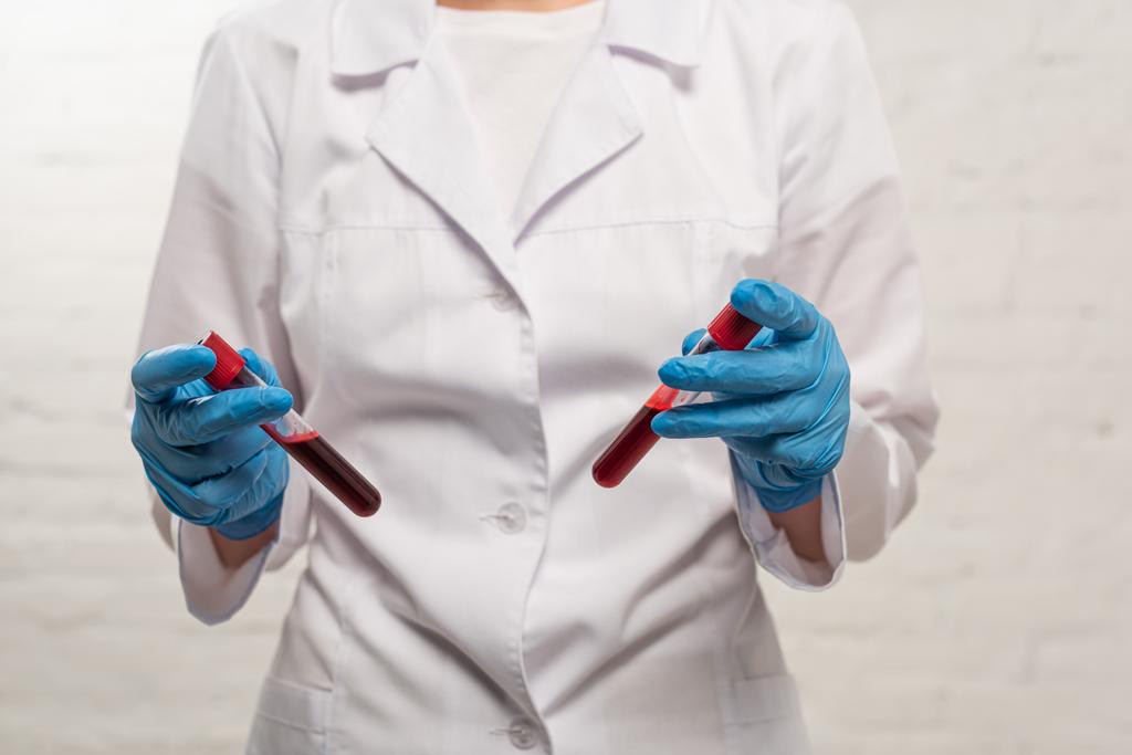 Vista recortada del médico sosteniendo tubos de ensayo con muestras de sangre sobre fondo blanco
 - Foto, Imagen
