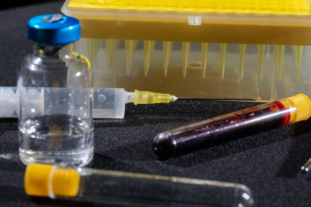 Každá lahvička s krví je transportována do laboratoře na specializované testy. - Fotografie, Obrázek