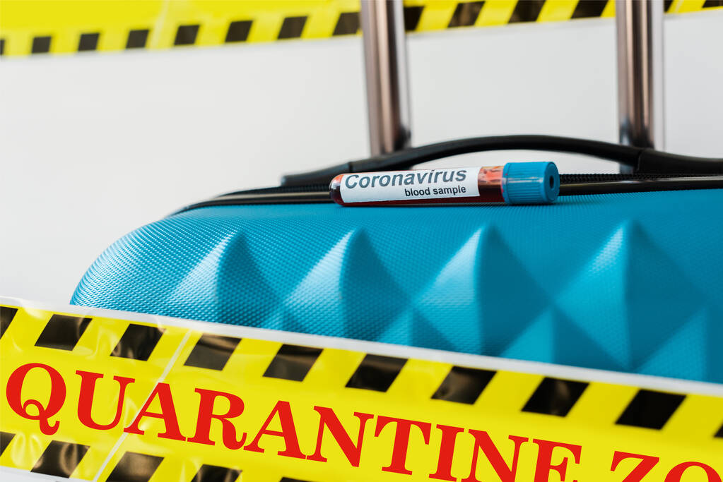 close-up zicht op blauwe koffer met coronavirus bloedmonster in geel en zwart gevarenwaarschuwingstape met quarantaineafbeelding geïsoleerd op wit - Foto, afbeelding
