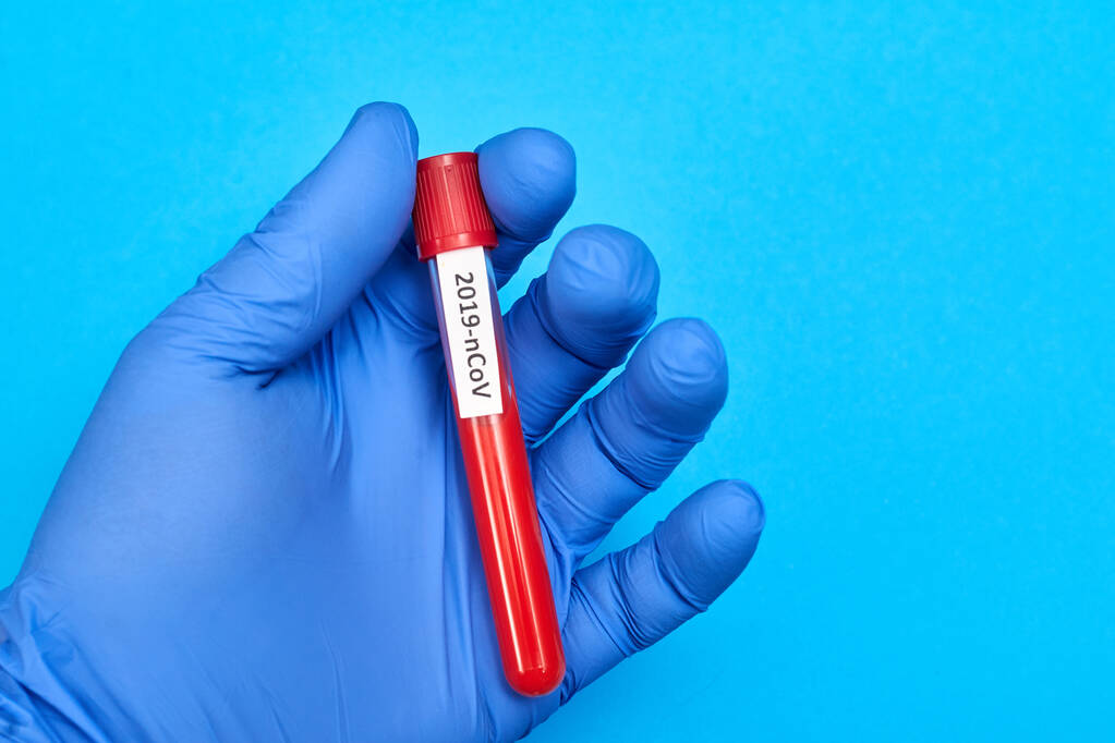 Coronavirus - felirat egy kémcsőre, vérrel a kezében, gumikesztyűben, kék alapon. - Fotó, kép