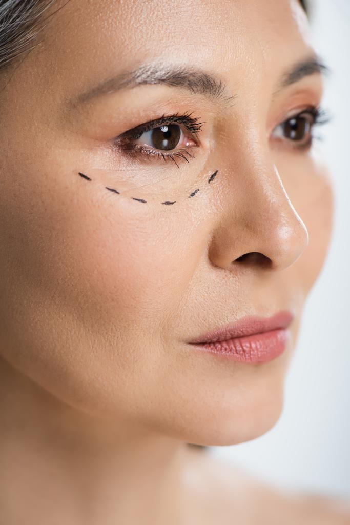 Yüzünde estetik ameliyat çizgileri olan Asyalı kadın gride izole edilmiş.  - Fotoğraf, Görsel