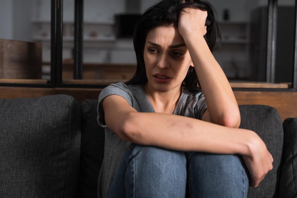 trieste vrouw met blauwe plekken op gezicht zittend op bank, huiselijk geweld concept  - Foto, afbeelding