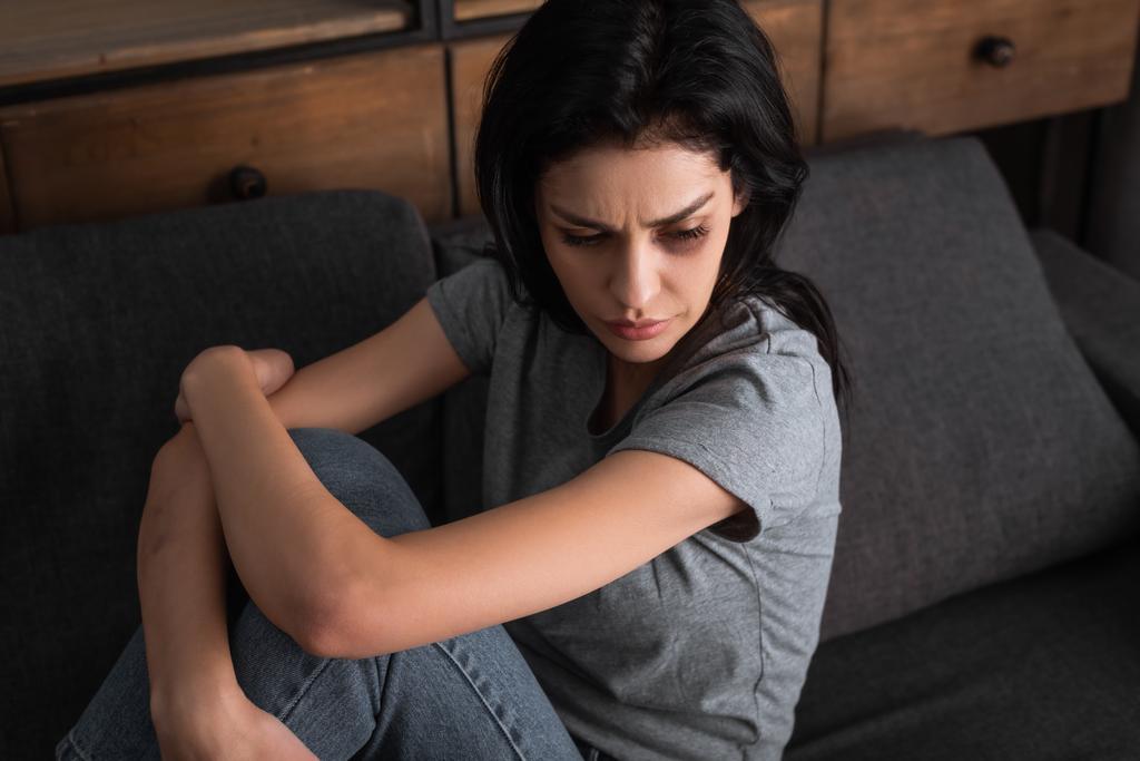 turhautunut nainen mustelmilla kasvoilla istuu sohvalla olohuoneessa, perheväkivallan käsite
  - Valokuva, kuva