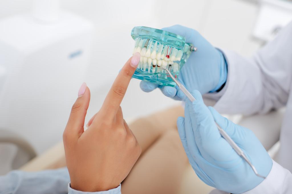 vista ritagliata di donna afro-americana che punta con il dito al modello di denti con carie vicino al dentista in guanti di lattice
  - Foto, immagini