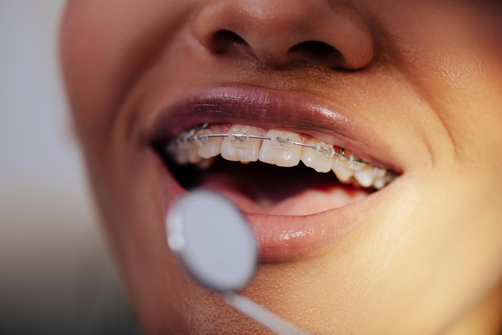 gros plan de heureuse femme afro-américaine dans les bretelles près du miroir dentaire
  - Photo, image