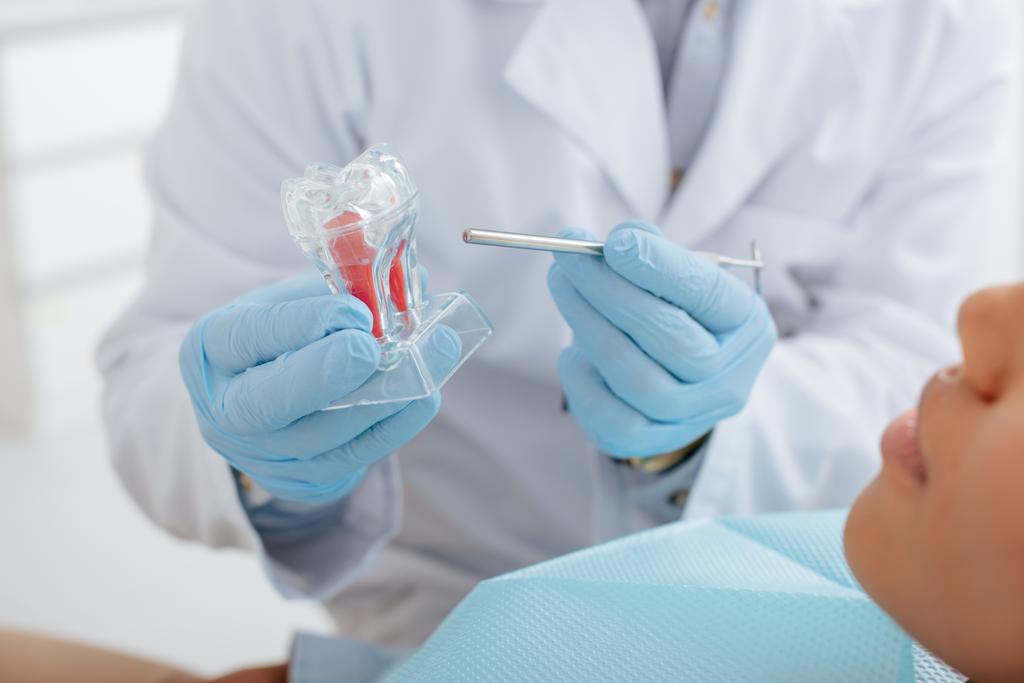 rajattu näkymä hammaslääkäri tilalla hammaslääkärin väline siisti hammas malli ja afrikkalainen amerikkalainen potilas
  - Valokuva, kuva