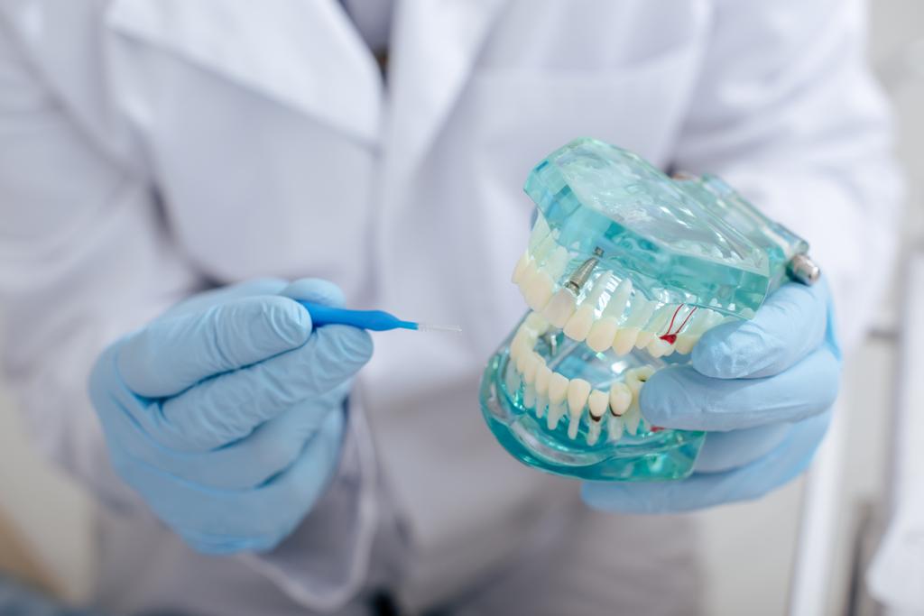 przycięty widok lekarza trzymającego szczotkę do czyszczenia zębów w pobliżu modelu zębów  - Zdjęcie, obraz