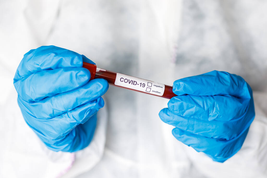 Covid 19 Koronavirus infikované krve v trubici v ruce vědec lékař biohazard ochrany oblečení v coronavirus výzkumné laboratoře. Výzkum vakcíny Coronavirus Covid-19. - Fotografie, Obrázek