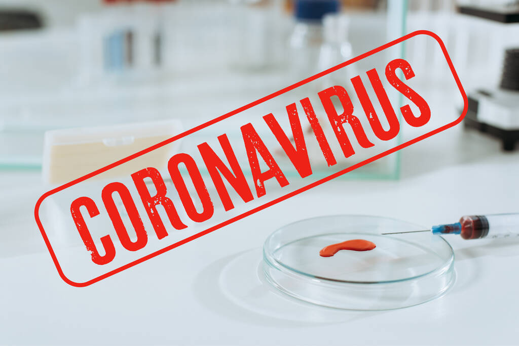 selective focus of syringe and petri dish with blood sample near white mouse in glass box, coronavirus illustration - Photo, Image