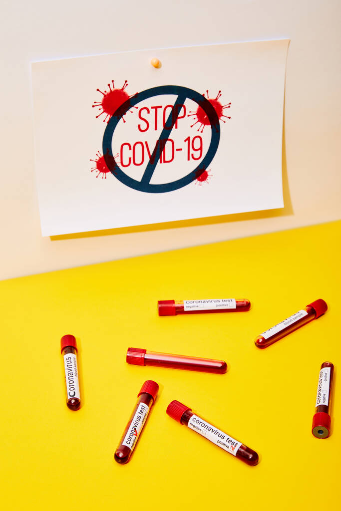 paper with stop covid-19 near test tubes with coronavirus test lettering on white and yellow - Photo, Image
