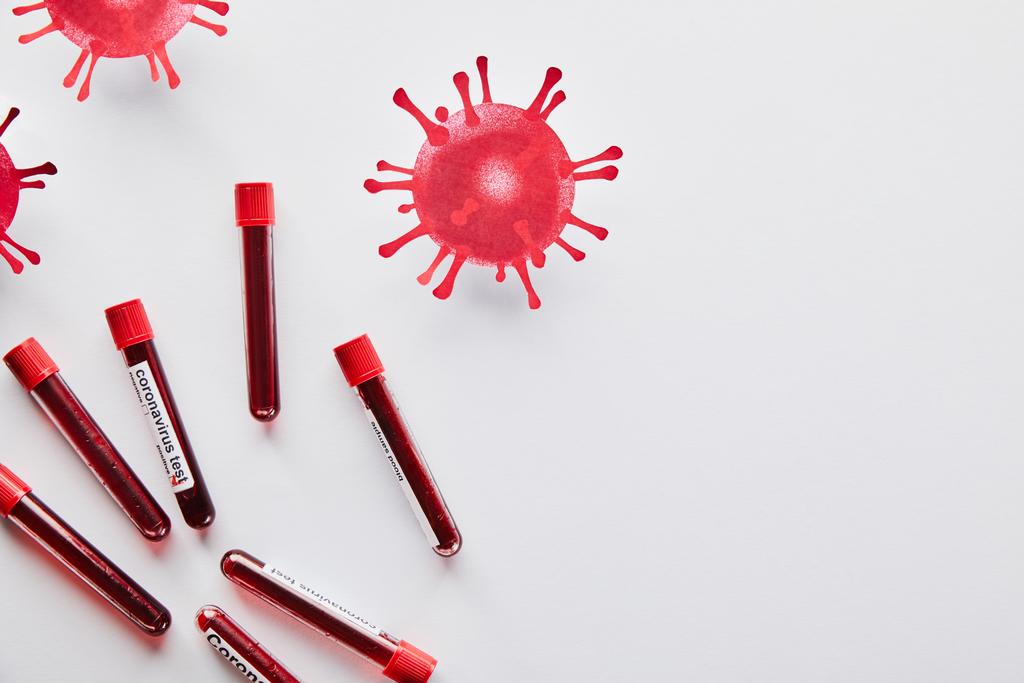 Ansicht von Reagenzgläsern mit Blutproben und Coronavirus-Test-Schriftzug in Virennähe auf weiß  - Foto, Bild