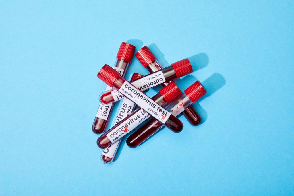 άνω όψη δοκιμαστικών σωλήνων με δείγματα αίματος και γράμματα δοκιμής του κορωναϊού σε μπλε  - Φωτογραφία, εικόνα