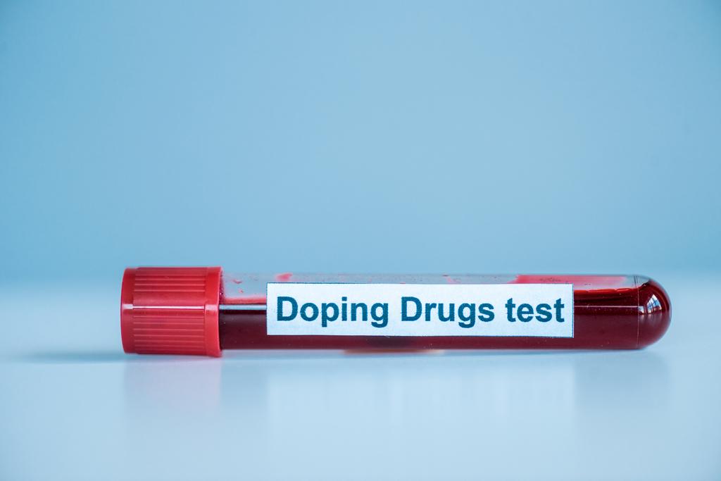 reageerbuis met monster- en dopingdrugs testletters op blauw  - Foto, afbeelding