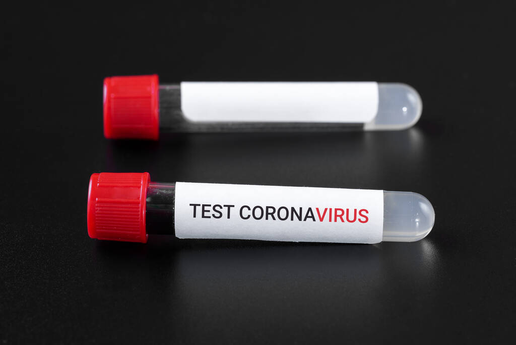 Text koronavirového testu na vakuové zkumavce s krevním testem a druhou zkumavkou s prázdným štítkem na černém pozadí. Koncepční covid-19 - Fotografie, Obrázek