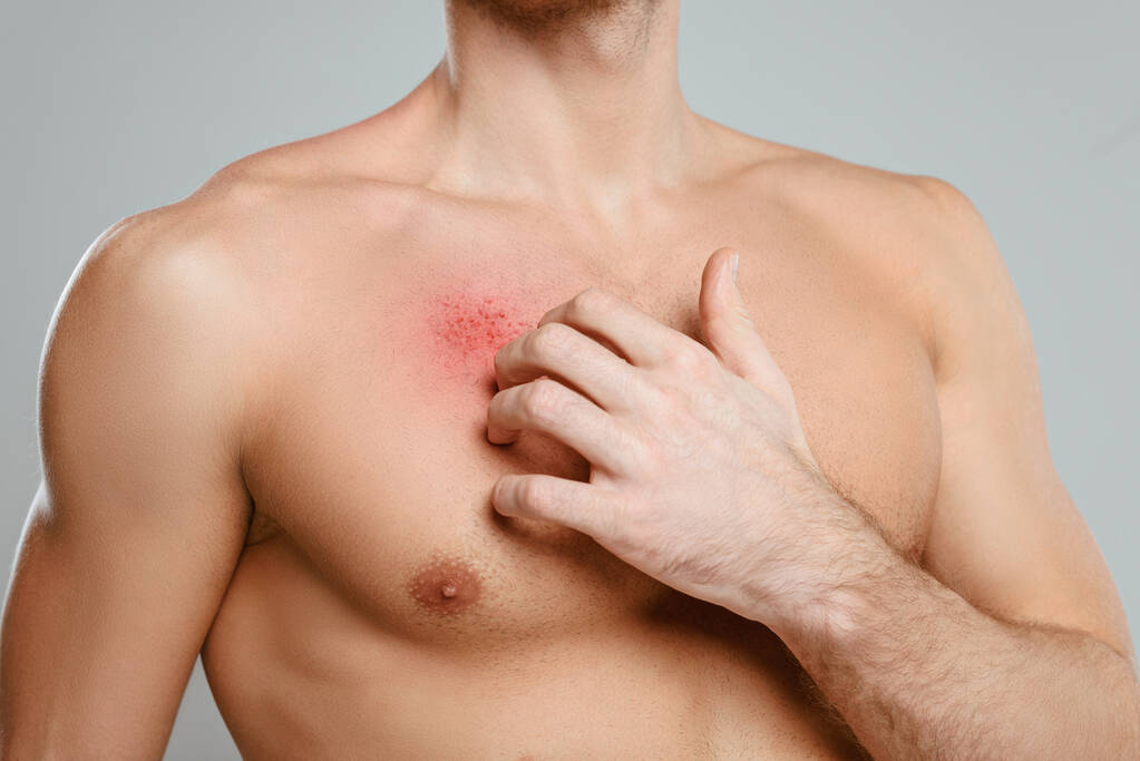 Vista parcial do homem arranhando a pele com alergia isolada no cinza
 - Foto, Imagem