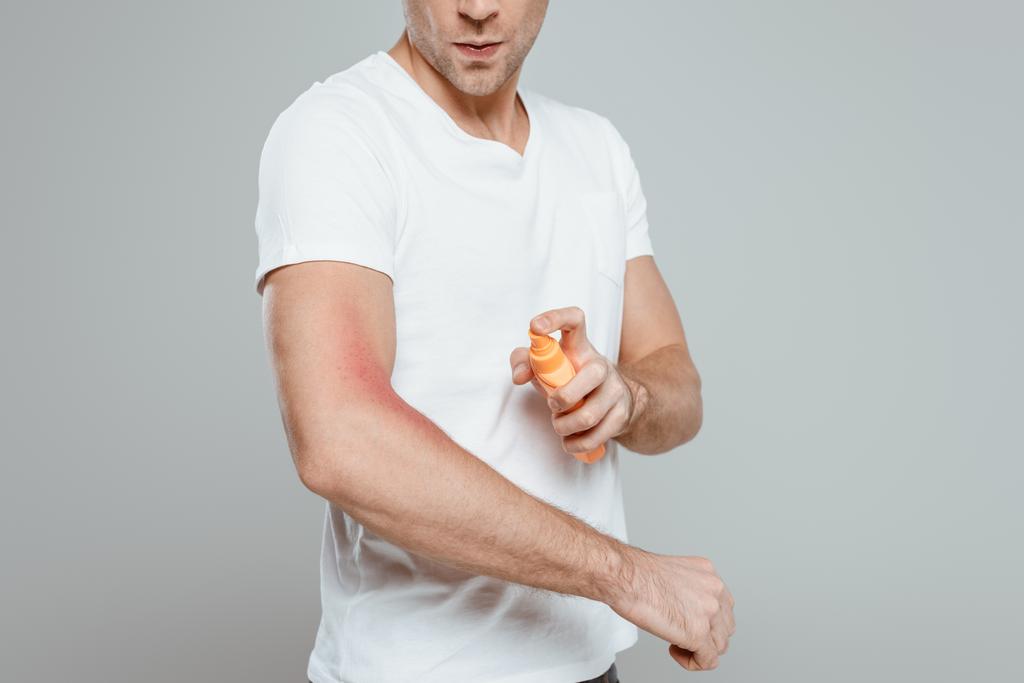 Обрізаний вид людини, що наносить сонцезахисний крем на руку з почервонінням ізольовано на сірий
 - Фото, зображення