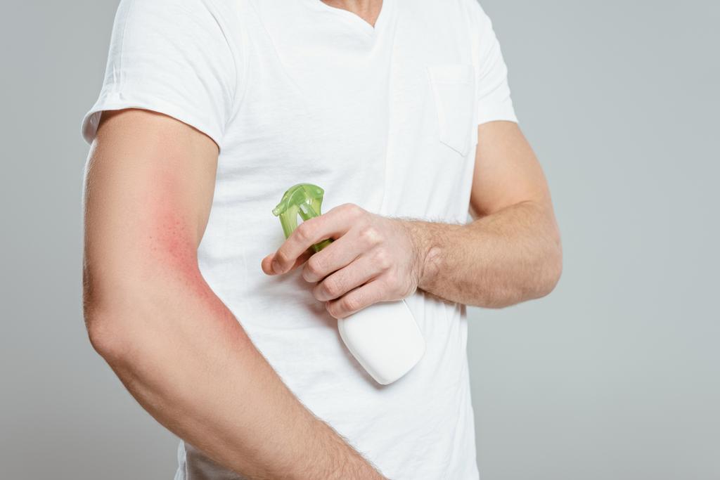 Обрізаний вид людини з алергією на руку за допомогою спрею ізольовано на сірому
 - Фото, зображення