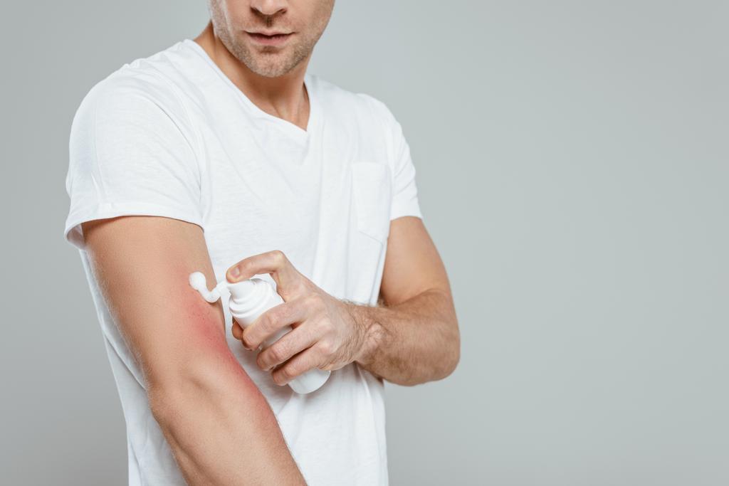 Vista recortada del hombre aplicando espuma en la mano con alergia aislada en gris
 - Foto, Imagen