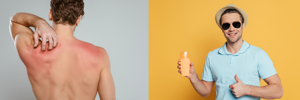 Коллаж загорелого человека с красной кожей на спине на сером фоне и человек показывает бутылку солнцезащитного крема и как знак на желтом фоне, панорамный снимок
 - Фото, изображение