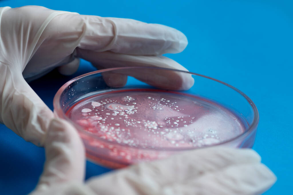 Kutatás a vírusok és baktériumok, a kutató tart egy Petri-csészében a minta. - Fotó, kép