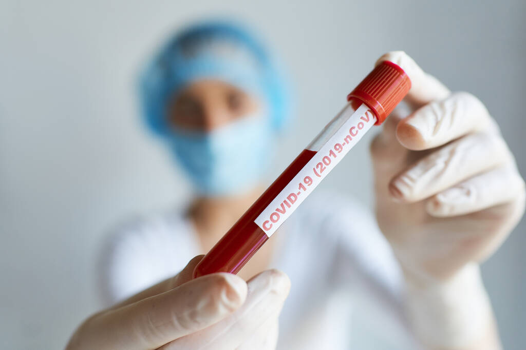 COVID-19分析用血液サンプルを用いた検査管を保持している研究室の看護師または科学者。診断コロナウイルスまたはcovid-19検査結果 - 写真・画像