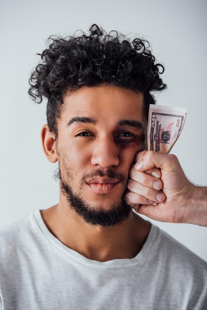 Mannelijke hand houdt dollars in de buurt van gezicht van Afrikaanse Amerikaanse man met blauwe plekken geïsoleerd op grijs - Foto, afbeelding