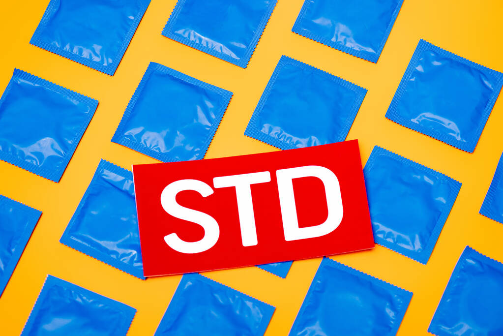 верхний вид бумаги с надписью std рядом с голубыми пакетами с презервативами, изолированными на оранжевом
  - Фото, изображение
