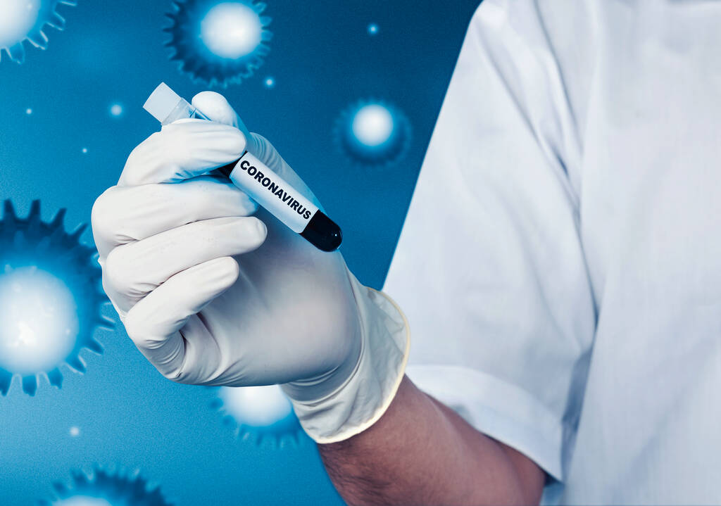 Doctor hombre con guantes protectores sosteniendo un tubo de ensayo con una muestra de sangre de coronavirus. Prevenir la gripe Coronavirus
 - Foto, imagen