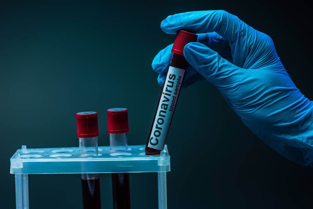 Oříznutý pohled na vědec drží trubice s koronavirem vzorek krve nápisy v blízkosti zkumavky stojan na tmavém pozadí - Fotografie, Obrázek