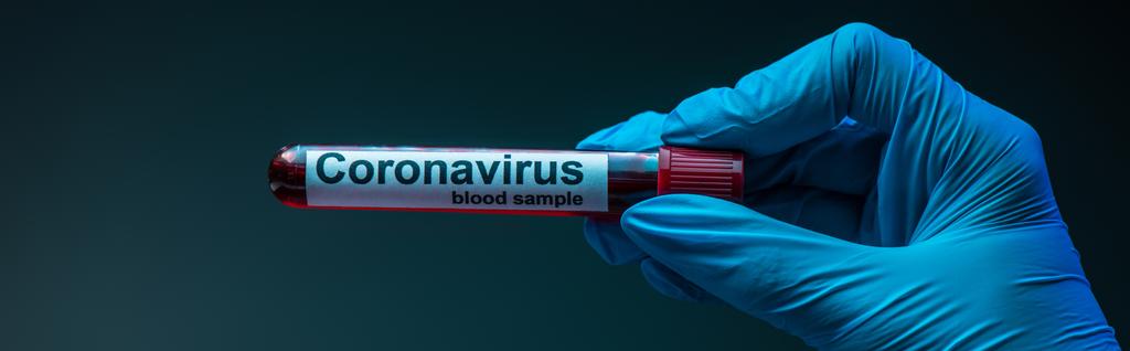 Cultivo horizontal del científico que muestra probeta con muestras de sangre de coronavirus sobre fondo oscuro
 - Foto, imagen