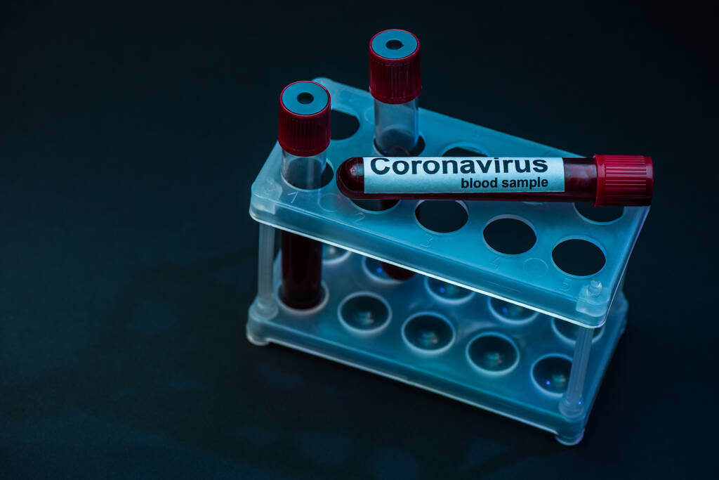 Vista en ángulo alto de los tubos de muestra con muestras de sangre de coronavirus en el estante del tubo de ensayo en la oscuridad
 - Foto, Imagen