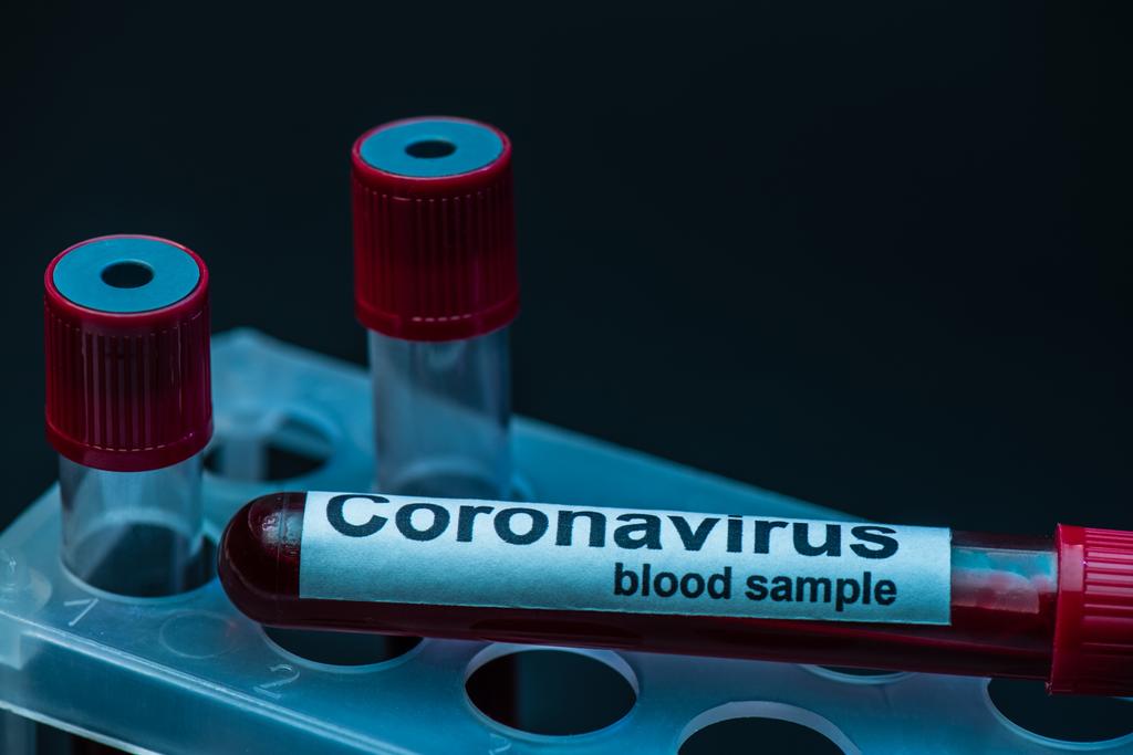 Monsterbuis met bloedmonster van het coronavirus belettering op reageerbuisrek op donker - Foto, afbeelding