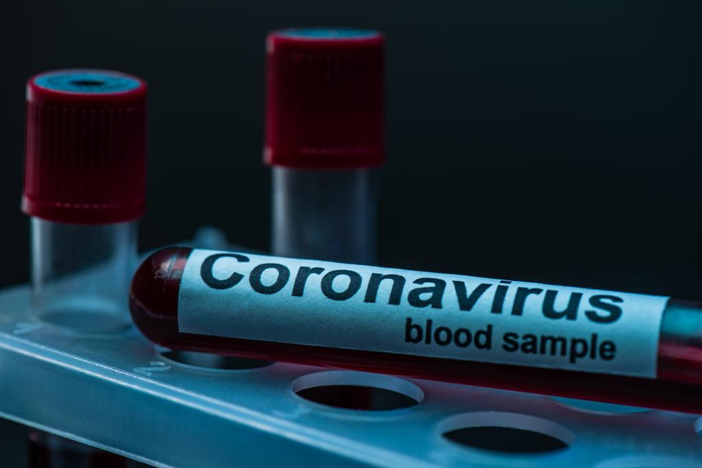 Foco seletivo do tubo de amostra com letras de amostra de sangue coronavírus no rack do tubo de teste no escuro
 - Foto, Imagem