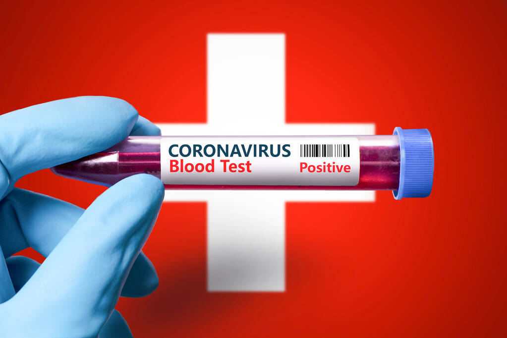 Een reageerbuis met een positieve test op coronavirus tegen de achtergrond van de vlag van Zwitserland. COVID-19 concept voor de bestrijding van de coronavirusepidemie in Zwitserland  - Foto, afbeelding