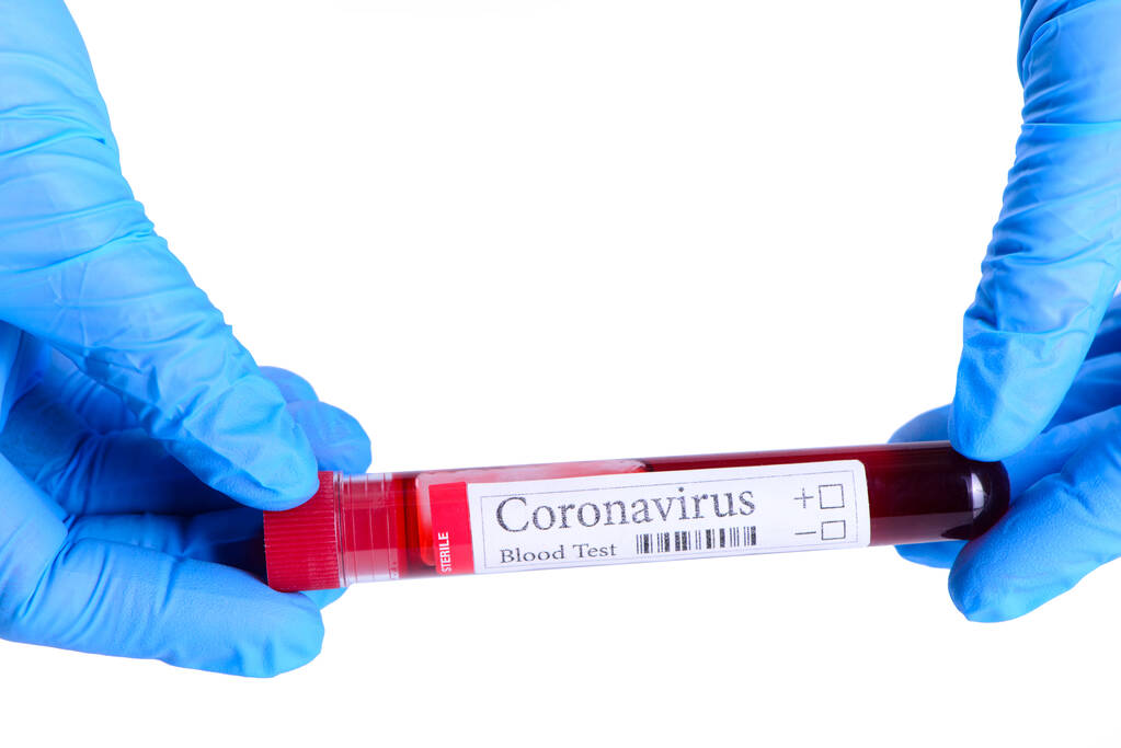 COVID-19 test et échantillon de laboratoire de test sanguin pour le diagnostic de l'infection par le coronavirus dans les mains de l'assistant de laboratoire isolé sur fond blanc et espace pour le concept annonces
 - Photo, image