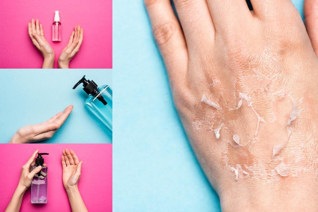 Collage einer weiblichen Hand mit dehydrierter, peelender Haut in der Nähe von Desinfektionsmitteln auf blau und rosa - Foto, Bild