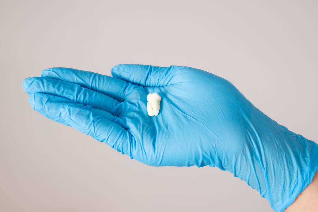 Extraktion von Weisheitszähnen, Nahaufnahme eines Zahnes auf behandschuhter Hand auf grauem Hintergrund, Konzept der Zahnmedizin - Foto, Bild