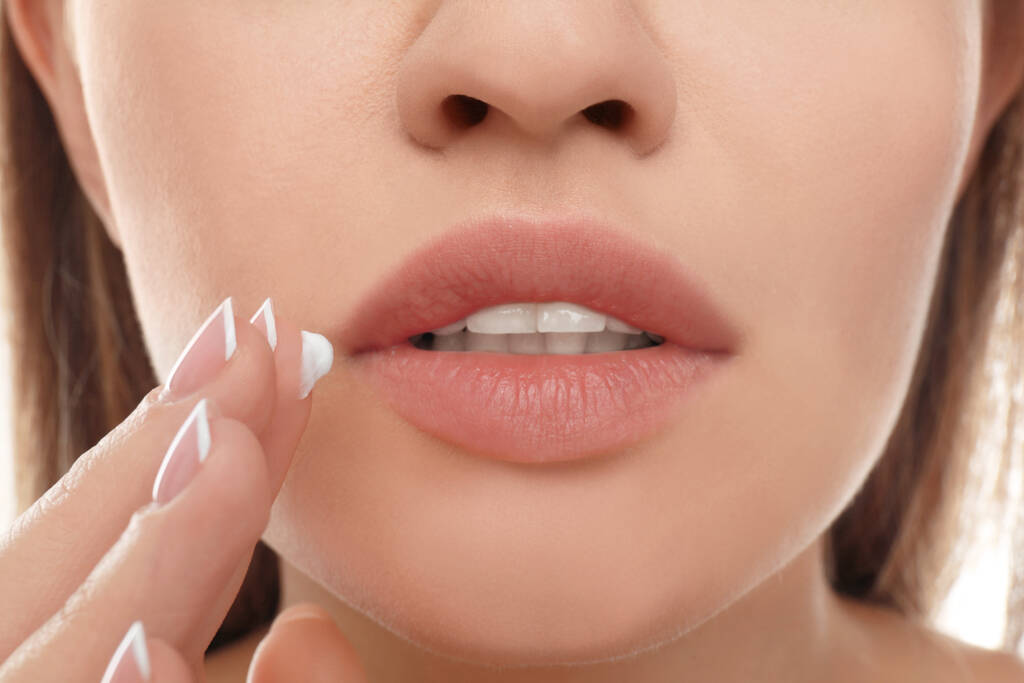 Mujer joven con herpes labial aplicar crema en los labios, primer plano - Foto, Imagen