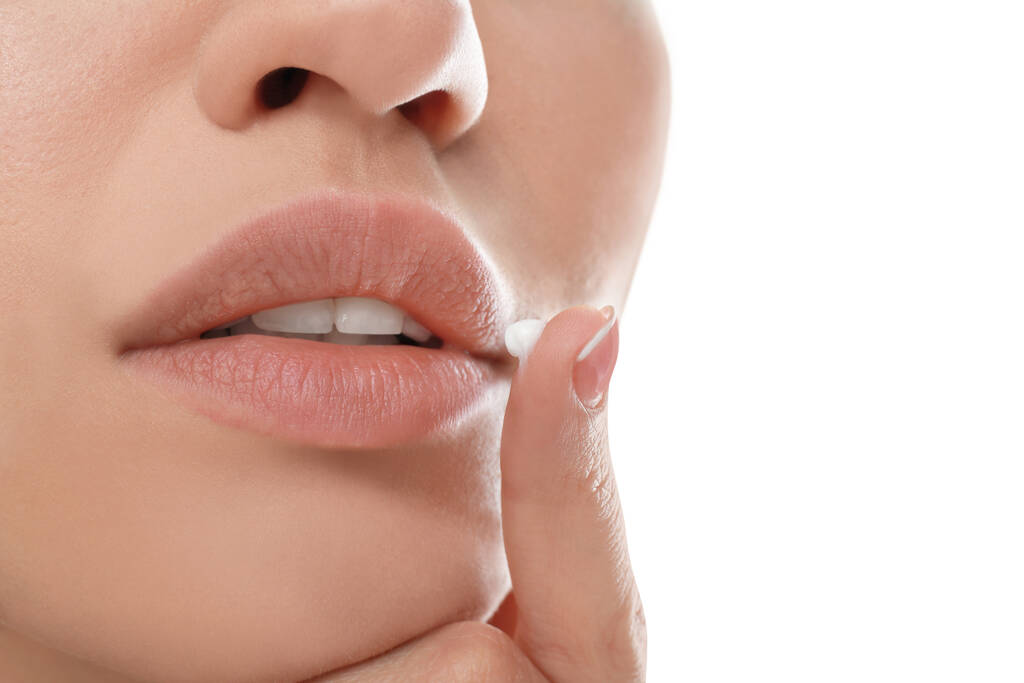 Mujer joven con herpes labial aplicando crema en los labios sobre fondo blanco, primer plano - Foto, imagen