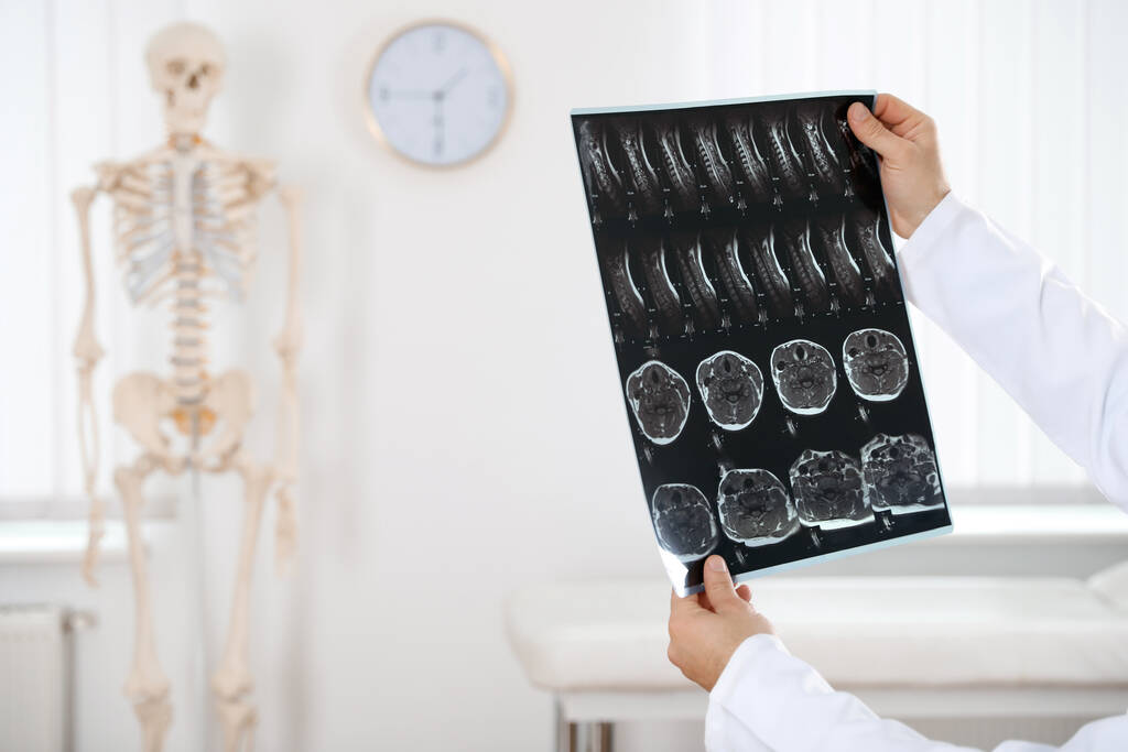 Ортопед осматривает рентген в клинике, крупным планом - Фото, изображение