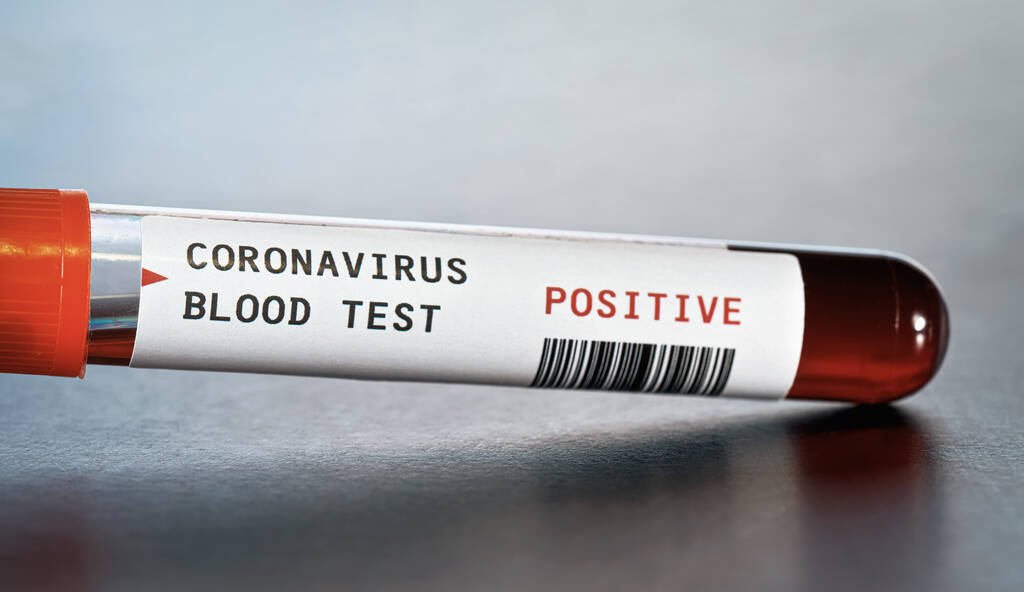 Vial de muestra con sangre, etiqueta dice coronavirus prueba, resultado positivo. (pegatina es de diseño propio, código de barras maniquí). Concepto de brote de Covid-19 - Foto, Imagen