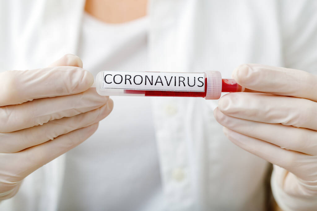 Coronavirus bloedonderzoek resultaat, bloed geïnfecteerd met coronavirus in vacuüm reageerbuis in artsen handen met tekst Coronavirus in het laboratorium. Diagnose, detectie, analyse van het Chinese coronavirus.. - Foto, afbeelding