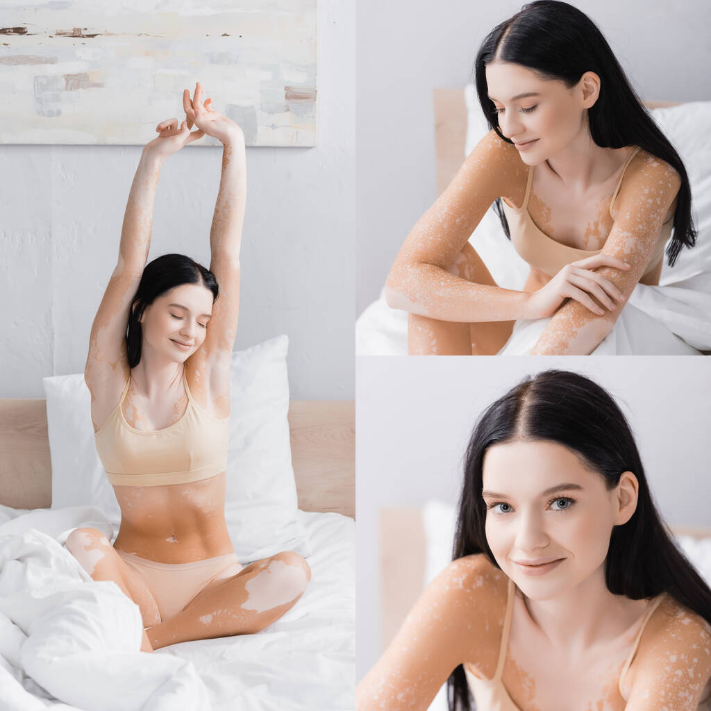 collage de mujer alegre con vitiligo sonriendo mientras se estira en la cama - Foto, imagen